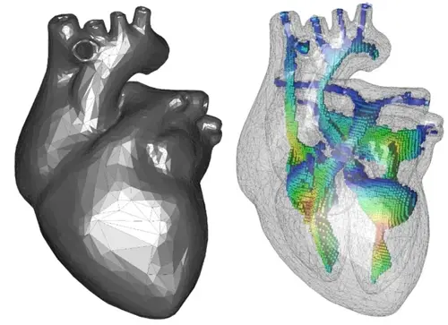 CADfix medial fields